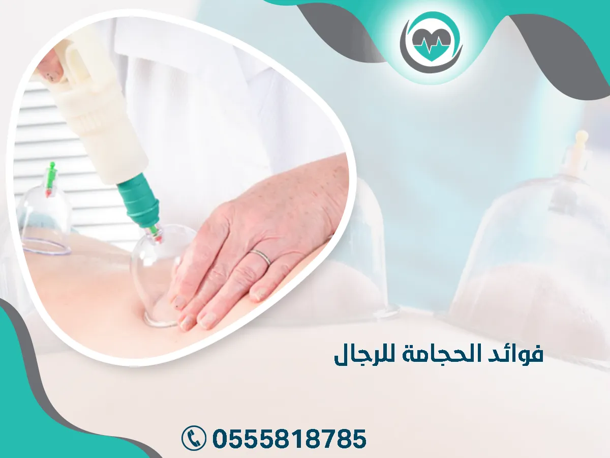 ما هي فوائد الحجامة للرجال