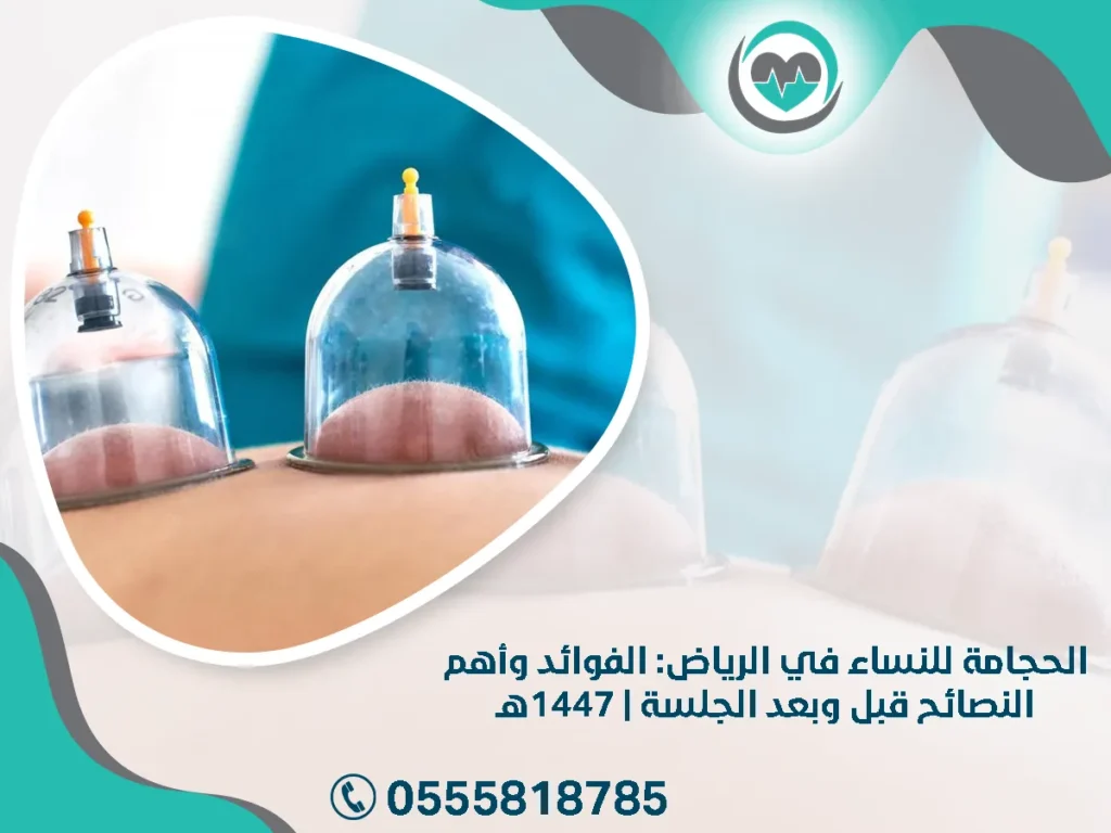 الحجامة للنساء في الرياض