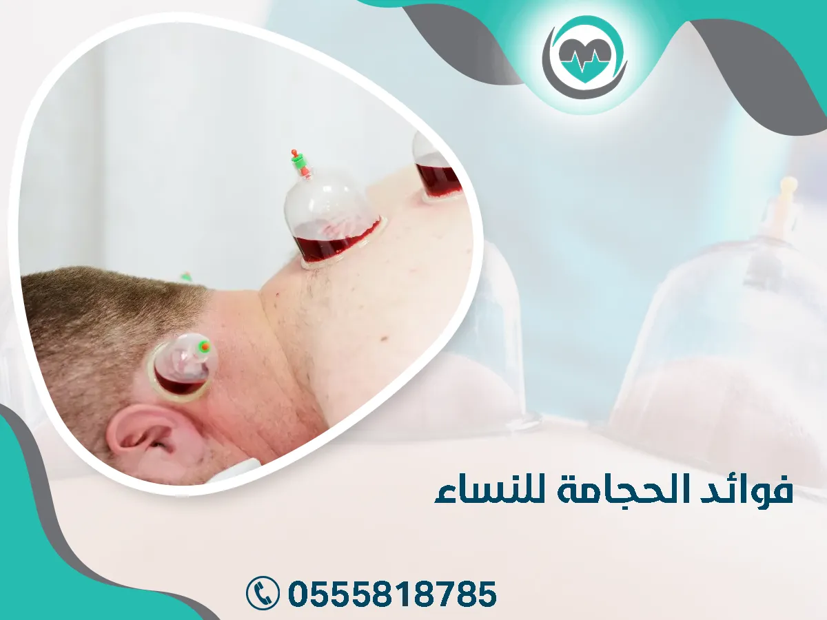 ما هي فوائد الحجامة للنساء