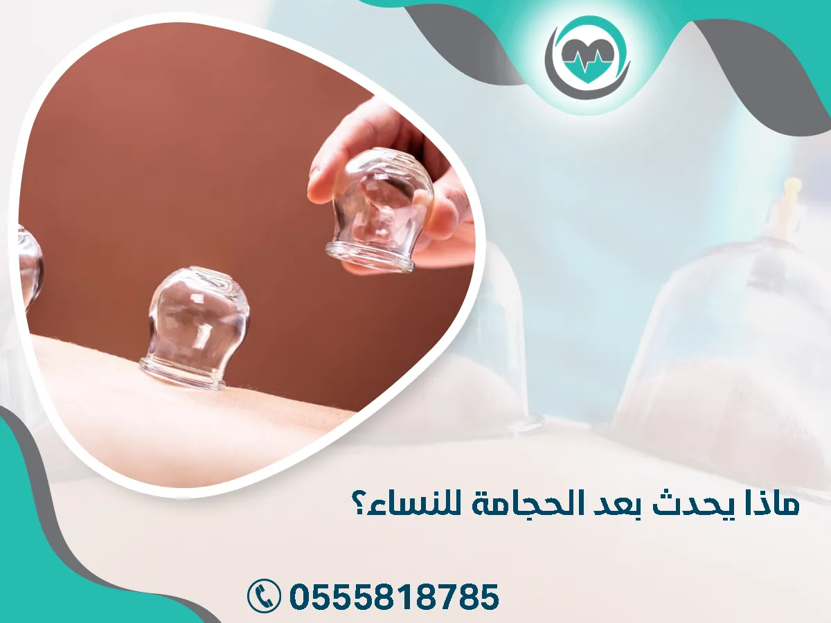 ما يحدث بعد الحجامة للنساء