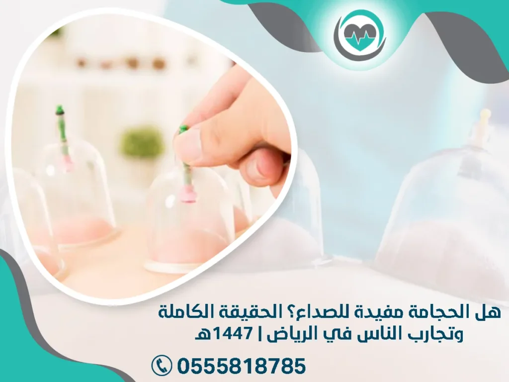 هل الحجامة مفيدة للصداع