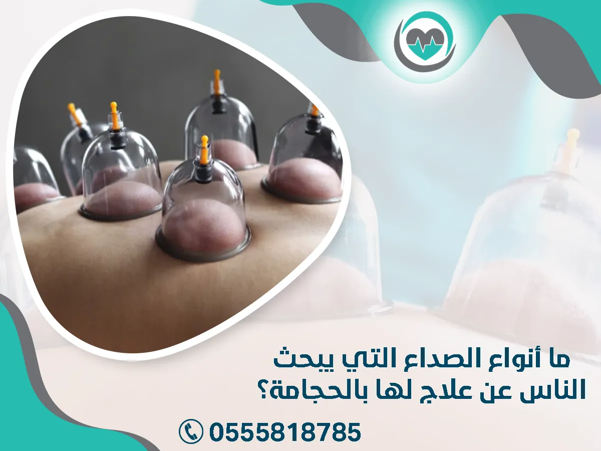 أنواع الصداع التي يبحث الناس عن علاج لها بالحجامة