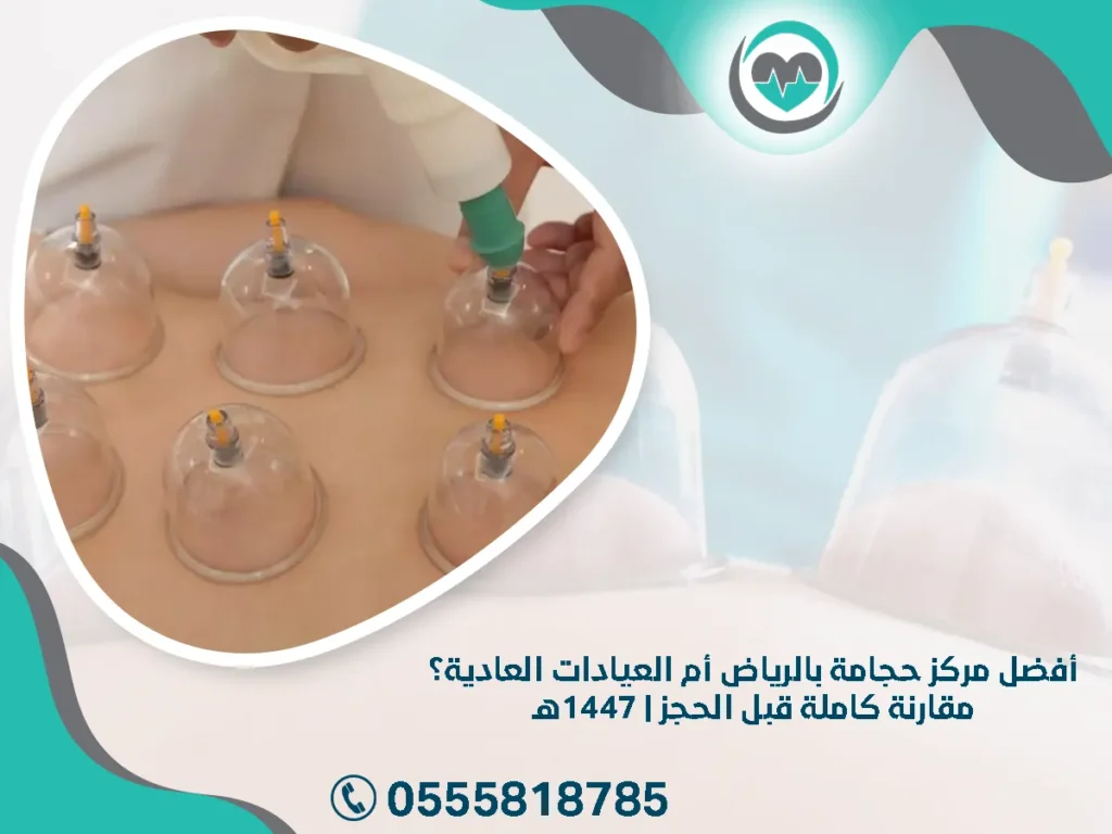 أفضل مركز حجامة بالرياض أم العيادات العادية؟ مقارنة كاملة قبل الحجز | 1447هـ