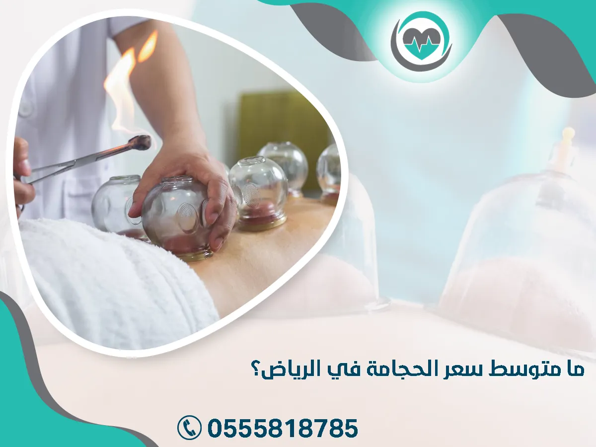 متوسط سعر الحجامة في الرياض