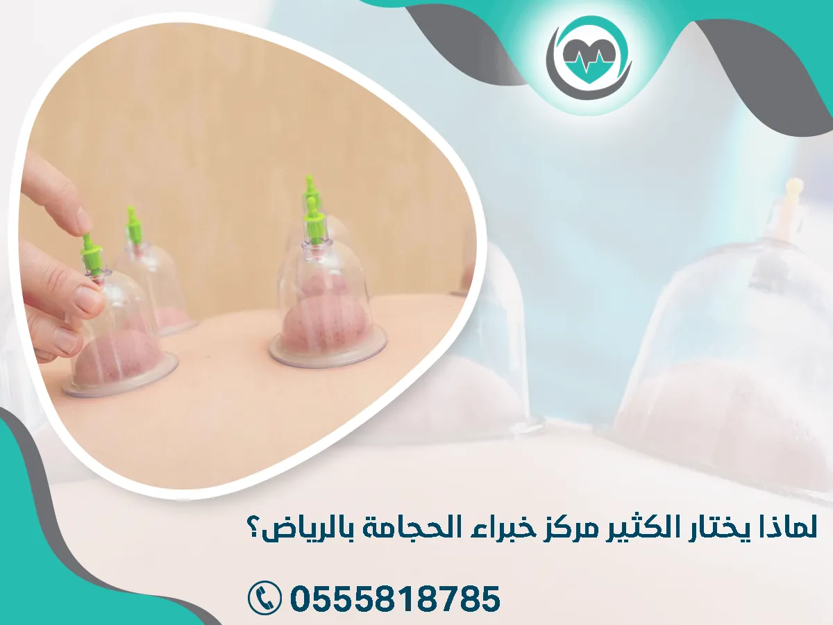 لماذا يفضل الناس مركز خبراء الحجامة بالرياض