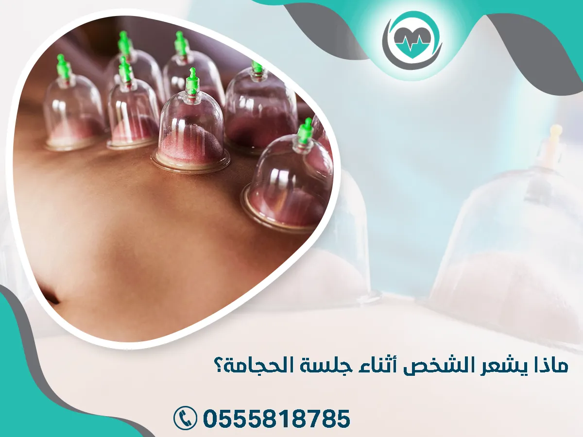 يشعر الشخص أثناء جلسة الحجامة