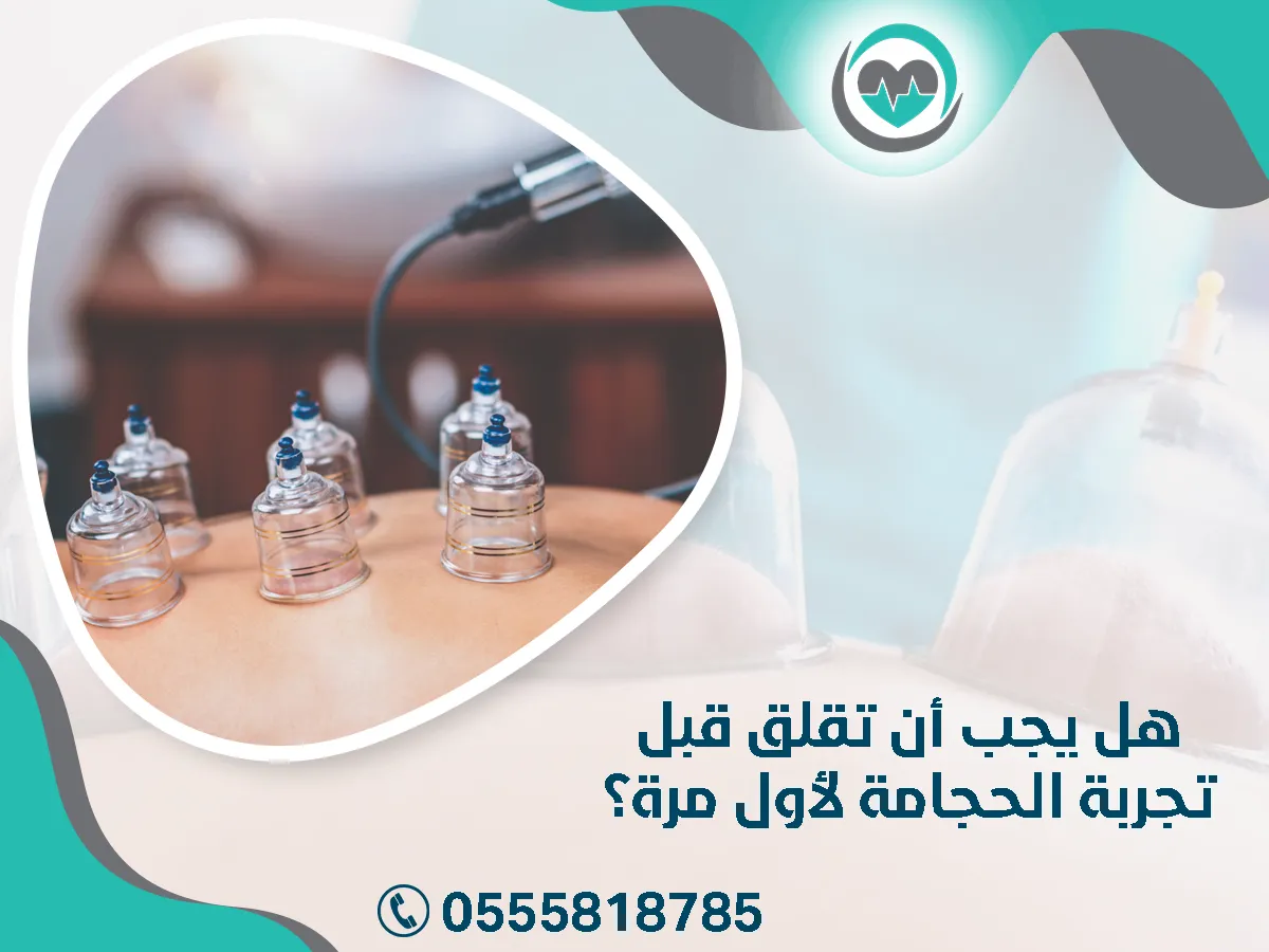 هل يجب أن تقلق قبل تجربة الحجامة لأول مرة