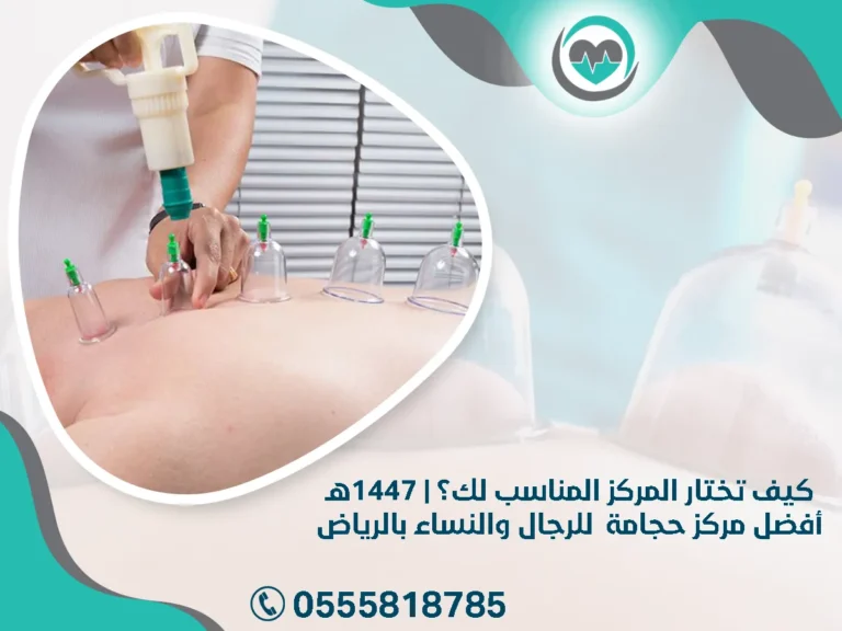 أفضل مركز حجامة للرجال والنساء بالرياض