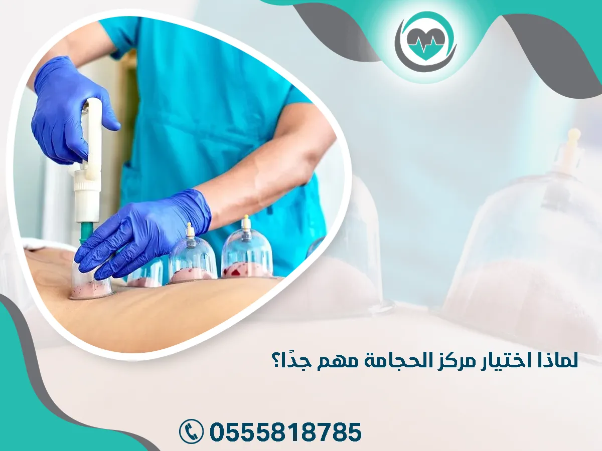 اختيار مركز الحجامة مهم جدًا