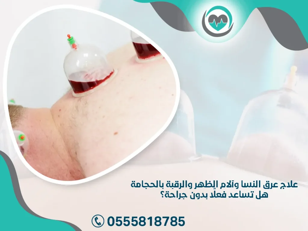 علاج عرق النسا وآلام الظهر والرقبة بالحجامة