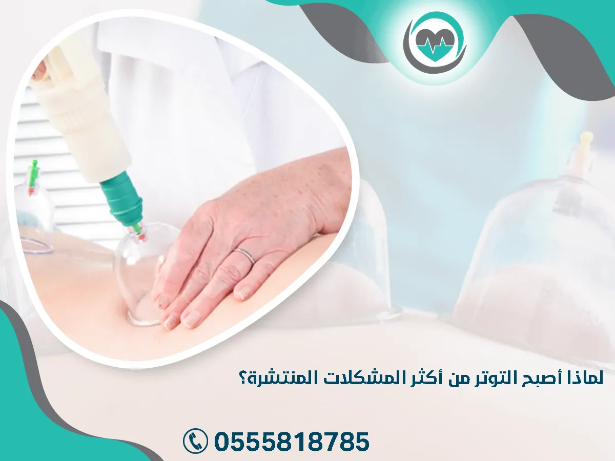أصبح التوتر من أكثر المشكلات المنتشرة