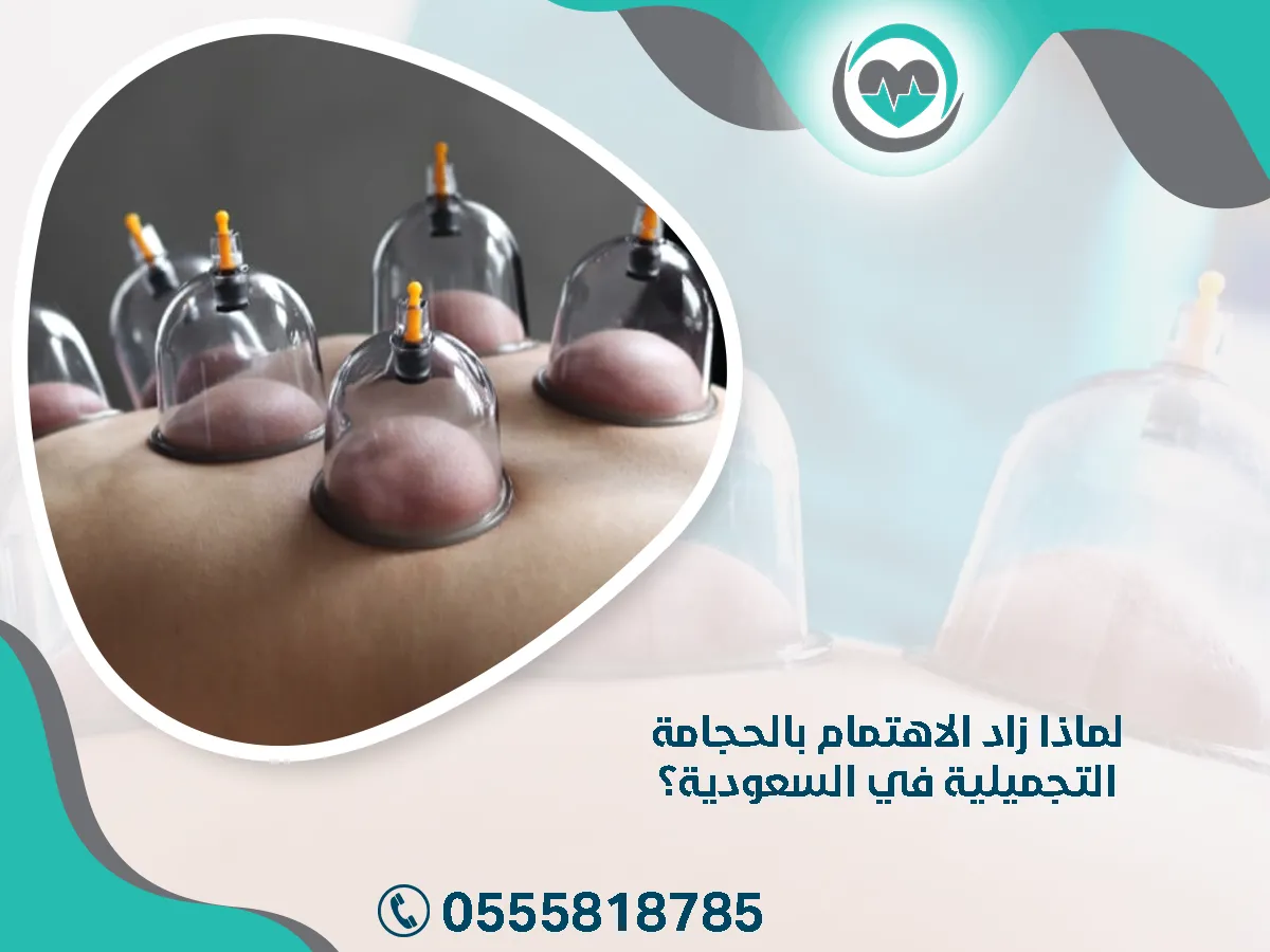 زاد الاهتمام بالحجامة التجميلية في السعودية