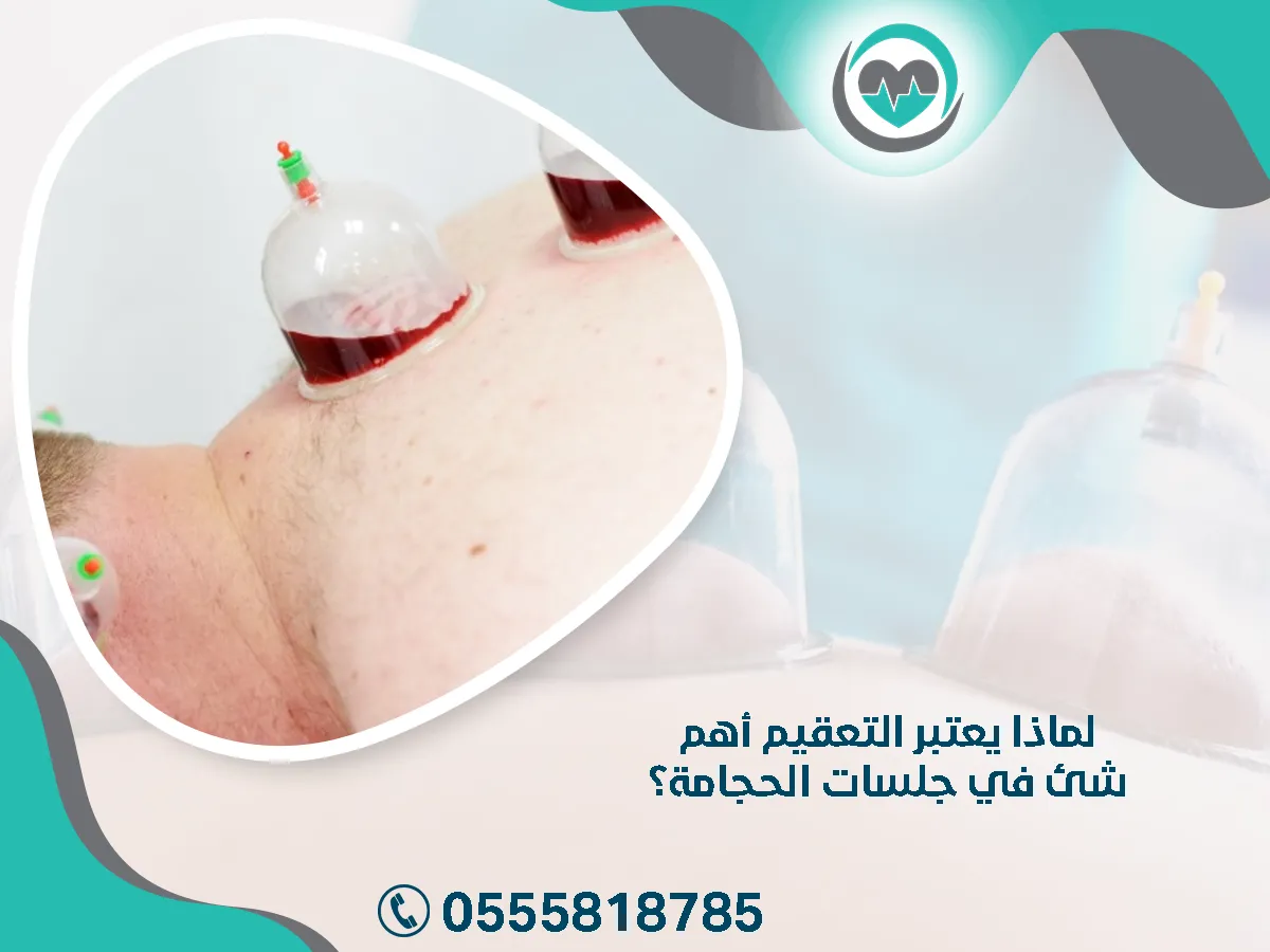 يعتبر التعقيم أهم شيء في جلسات الحجامة