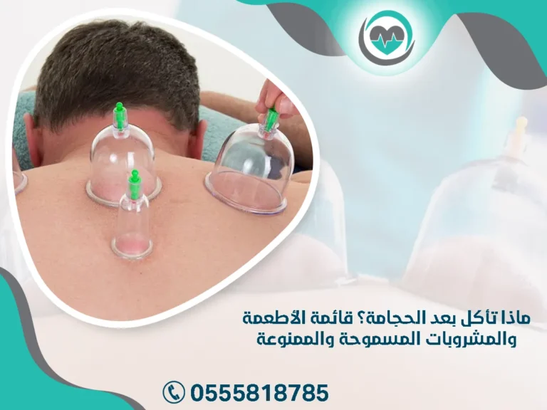 ماذا تأكل بعد الحجامة؟