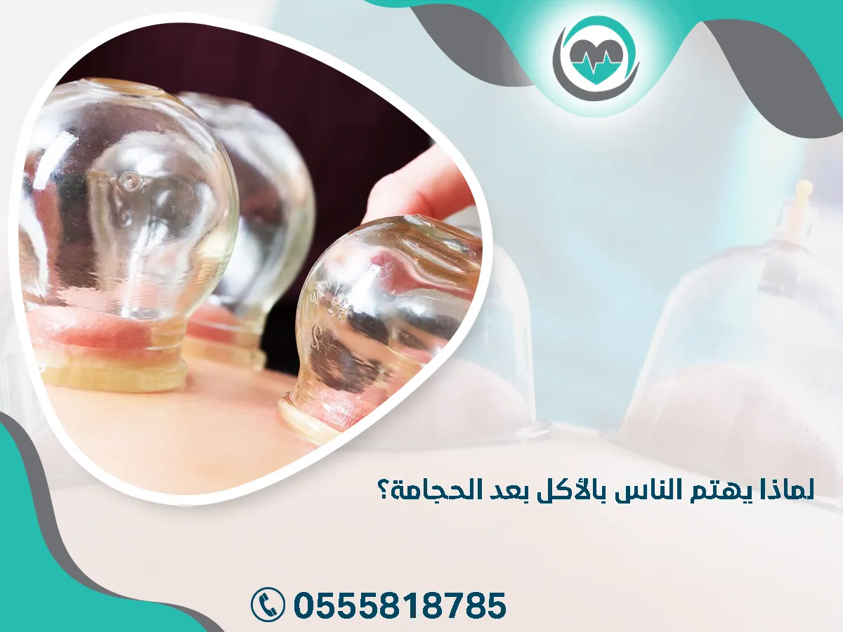 يهتم الناس بالأكل بعد الحجامة