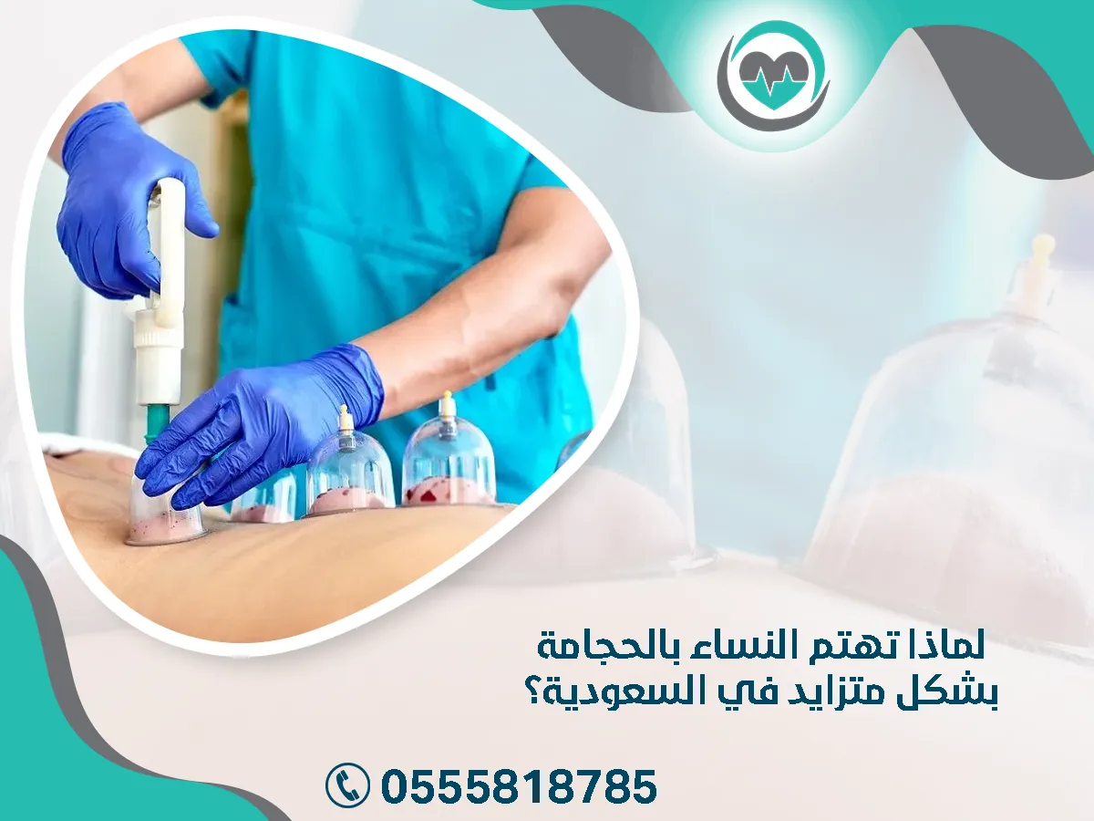 تهتم النساء بالحجامة بشكل متزايد في السعودية