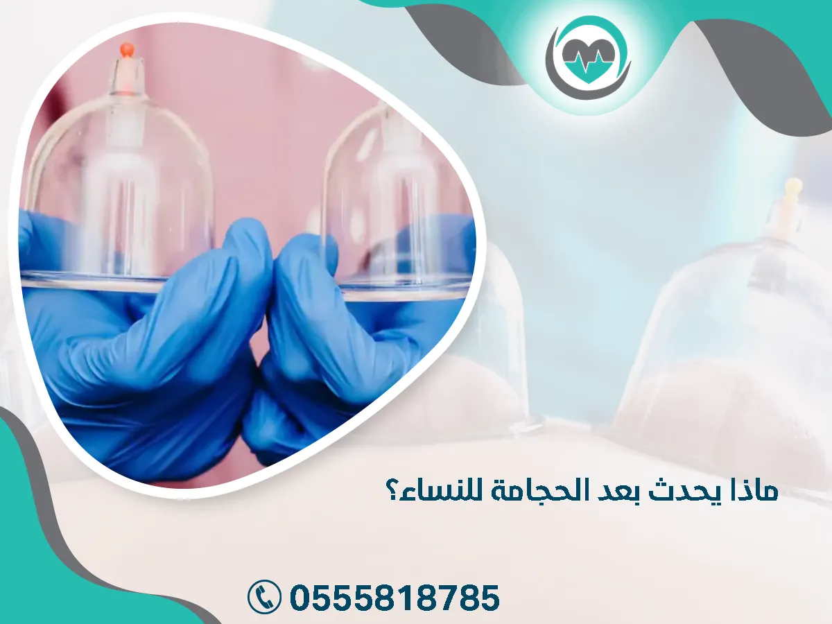 ما يحدث بعد الحجامة للنساء