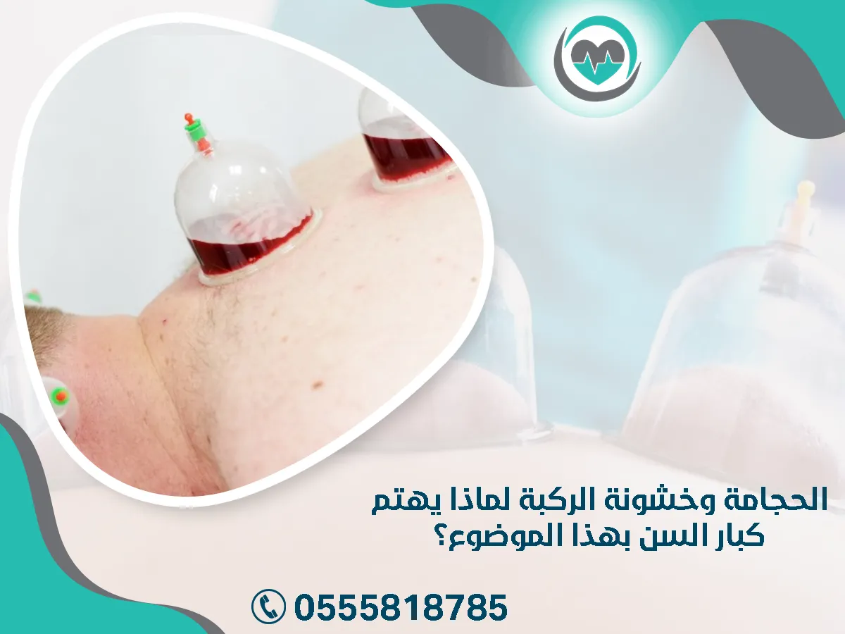 الحجامة وخشونة الركبة