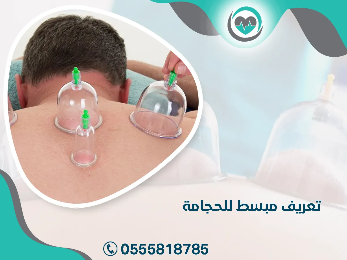 ما هي الحجامة؟