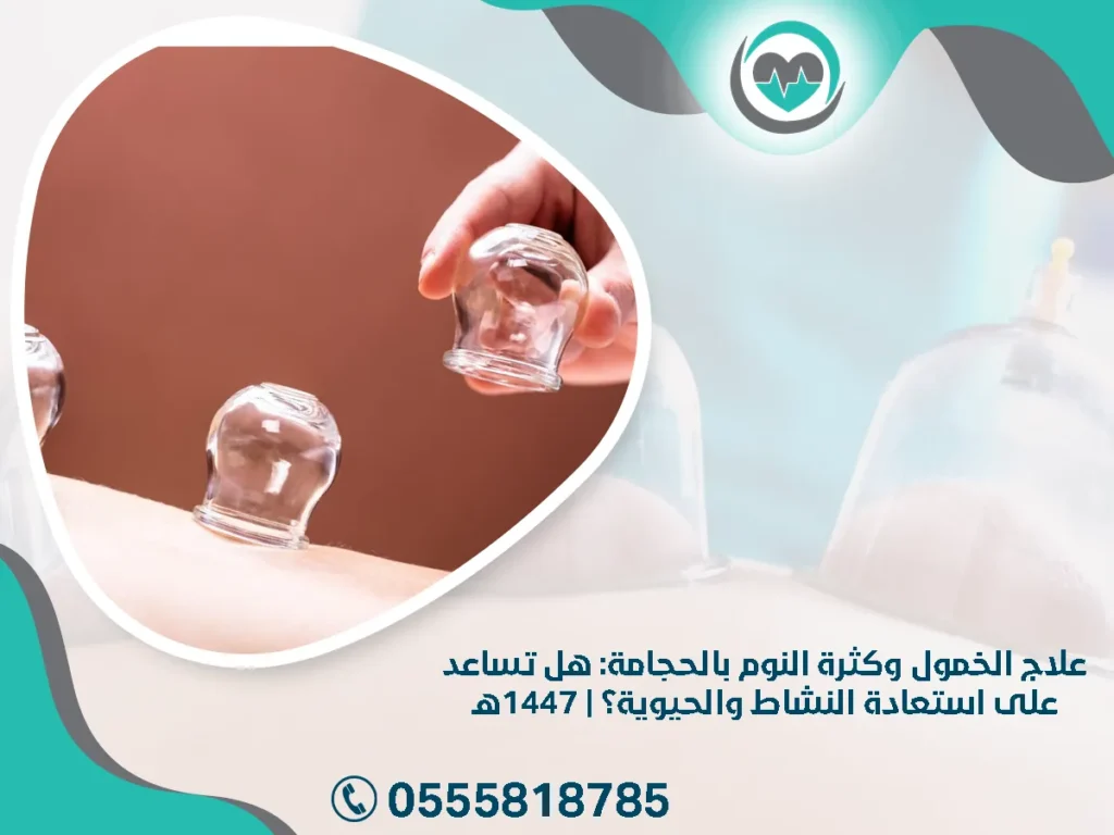 علاج الخمول وكثرة النوم بالحجامة: هل تساعد على استعادة النشاط والحيوية؟ | 1447هـ