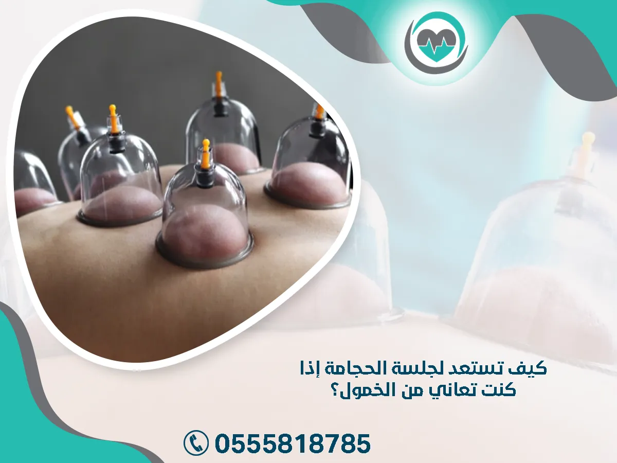 تستعد لجلسة الحجامة إذا كنت تعاني من الخمول