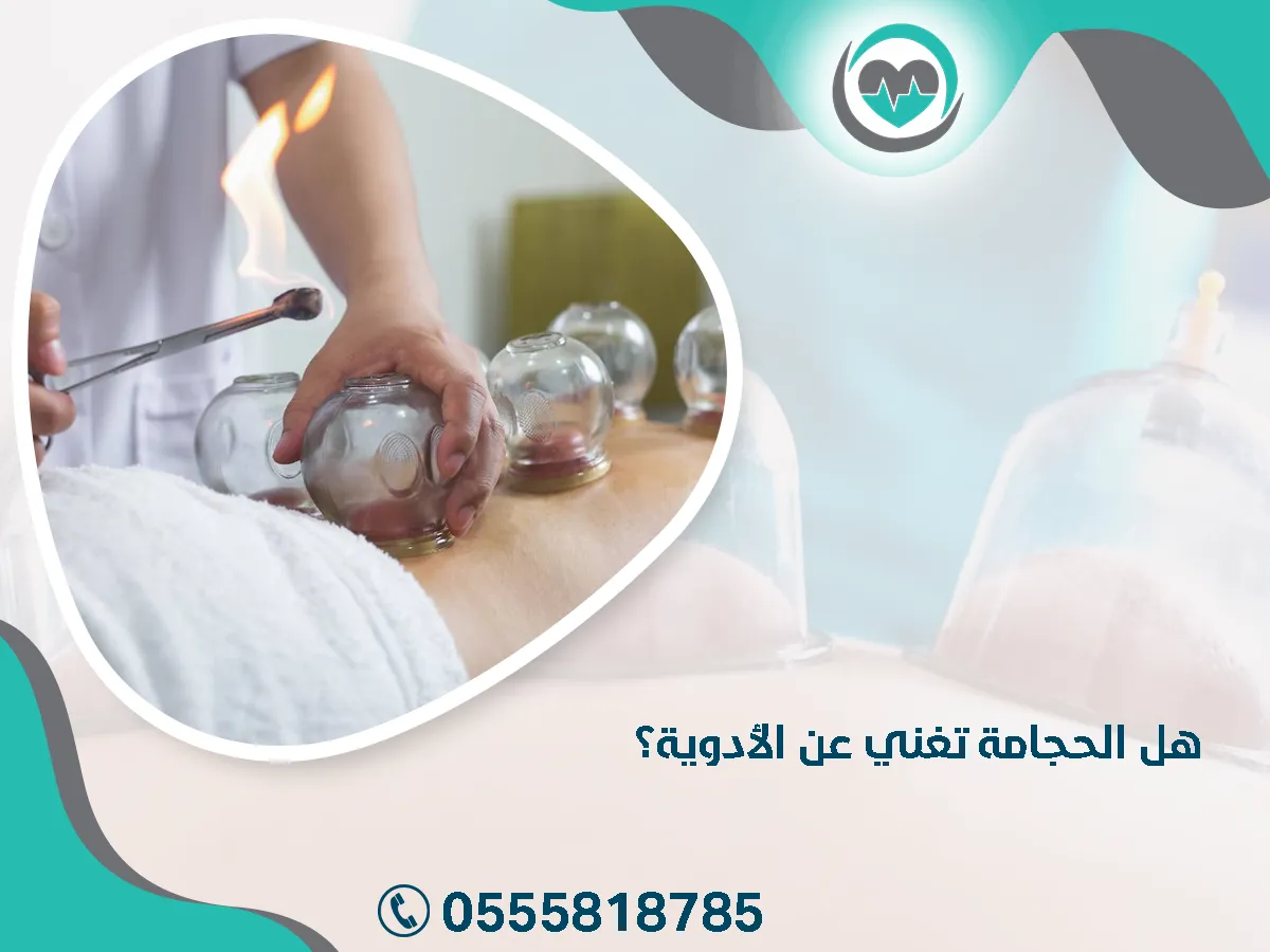 الحجامة تغني عن الأدوية