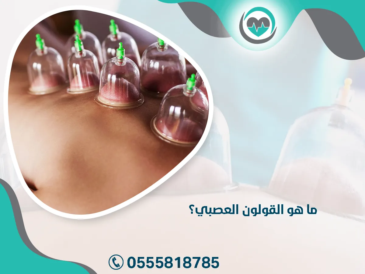 القولون العصبي