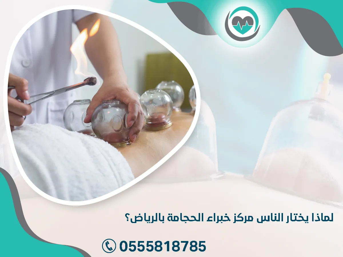 يختار الناس مركز خبراء الحجامة بالرياض