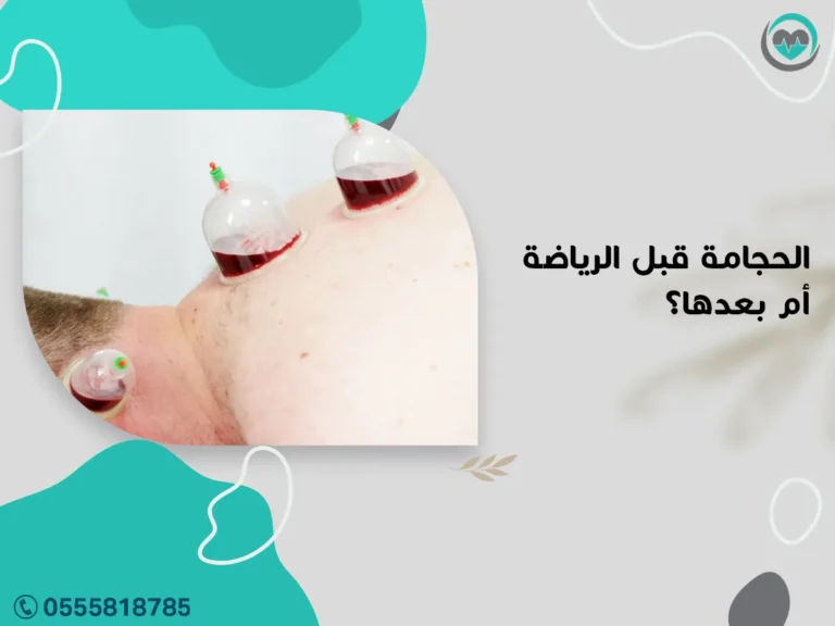 الحجامة قبل الرياضة أم بعدها؟ وأيهما أفضل للرياضيين؟ | 1447هـ