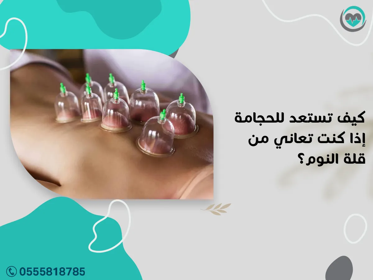 أستعد للحجامة إذا كنت تعاني من قلة النوم