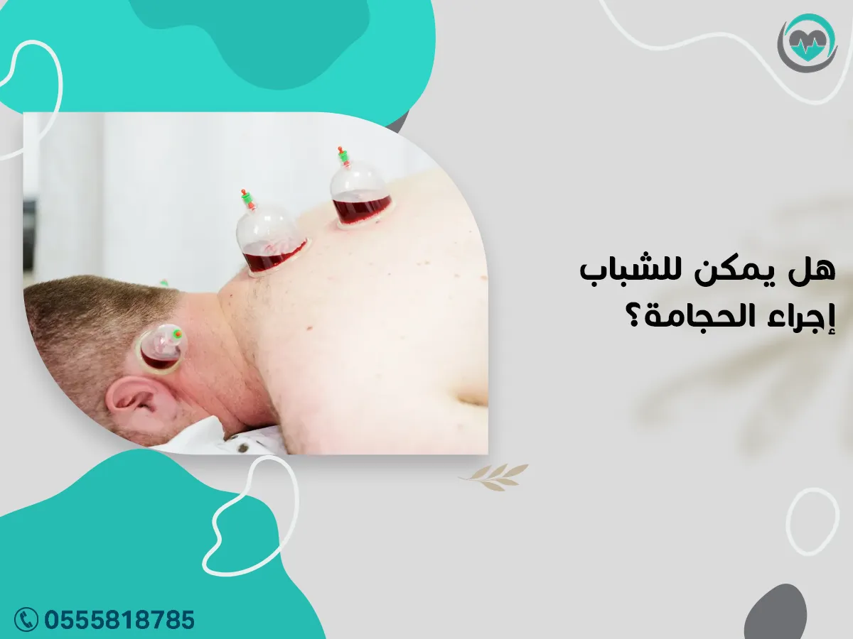 يمكن للشباب إجراء الحجامة