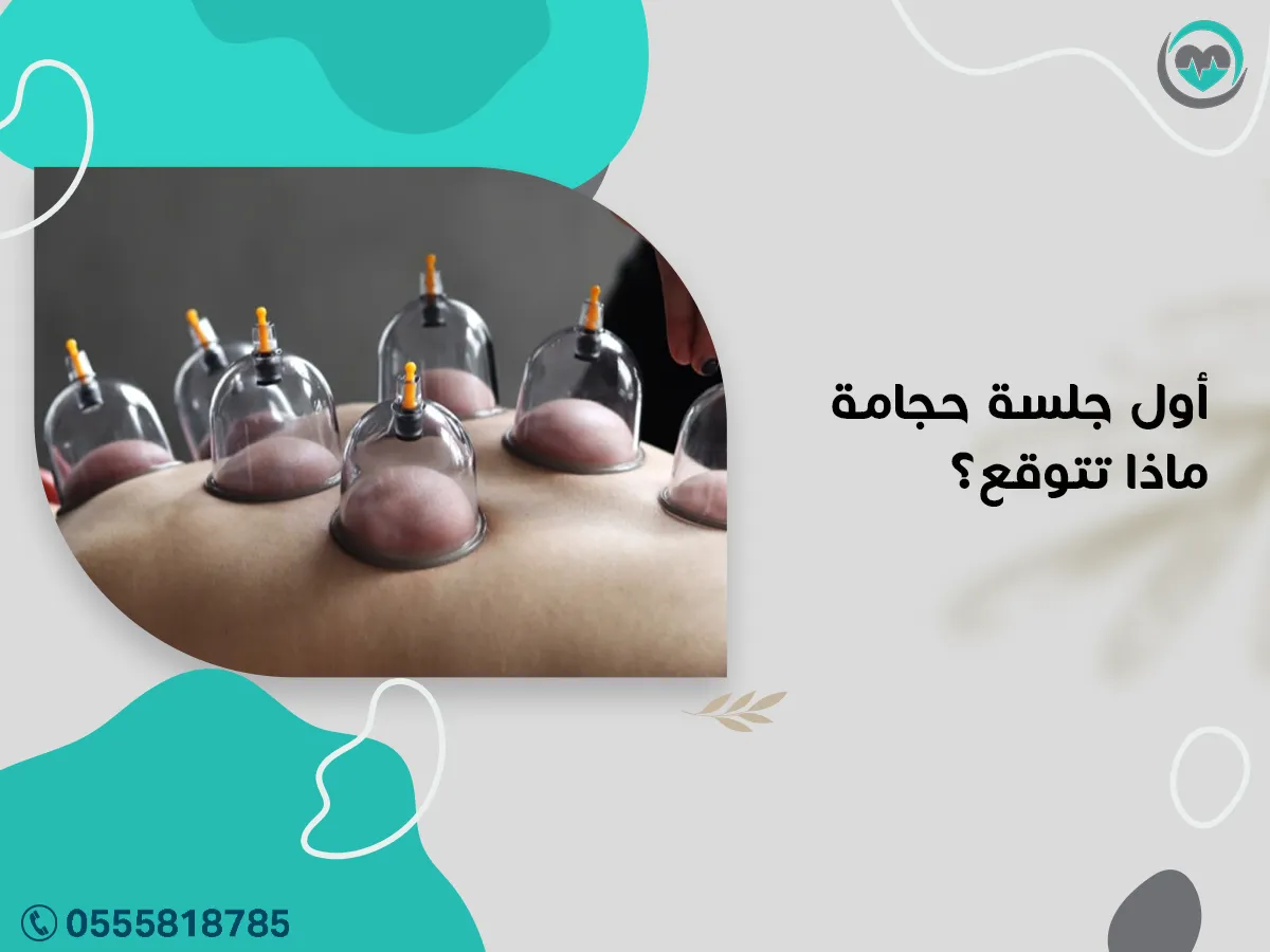 ماذا تتوقع من أول جلسة حجامة