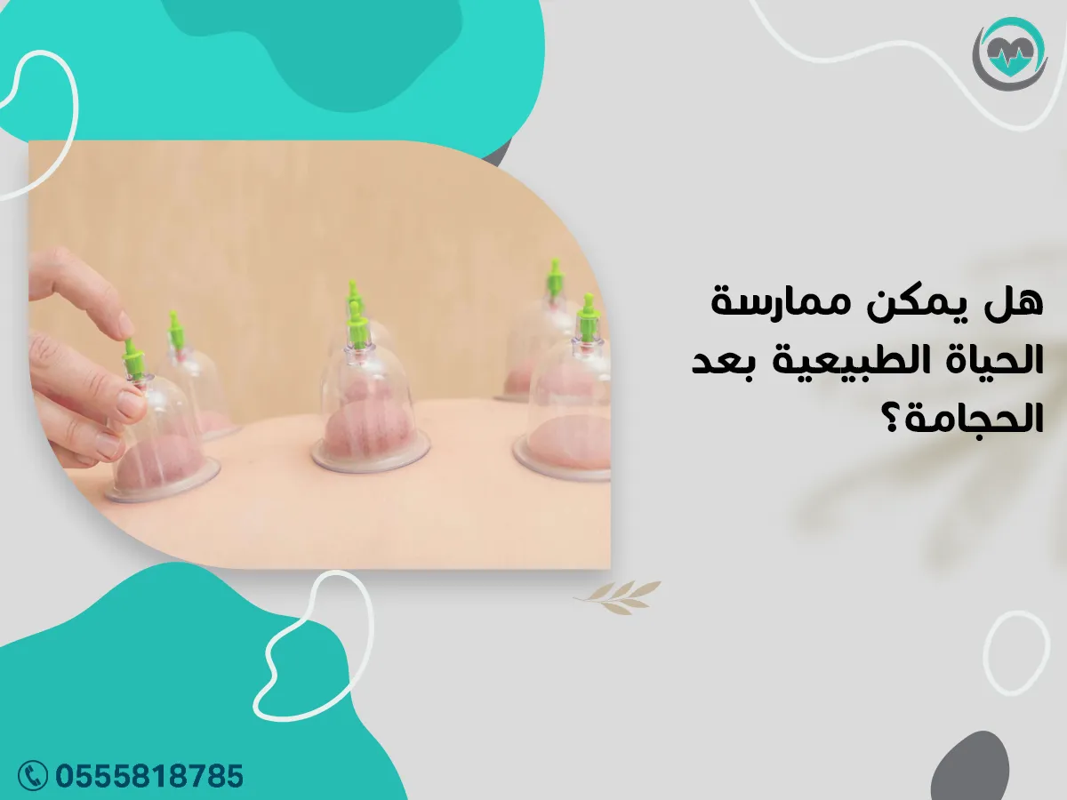 ممارسة الحياة الطبيعية بعد الحجامة