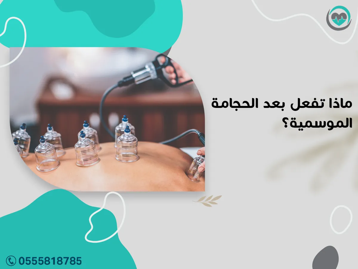 ما بعد الحجامة الموسمية