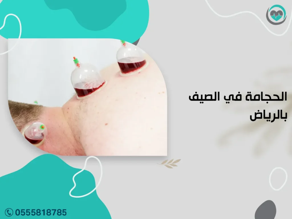 الحجامة في الصيف