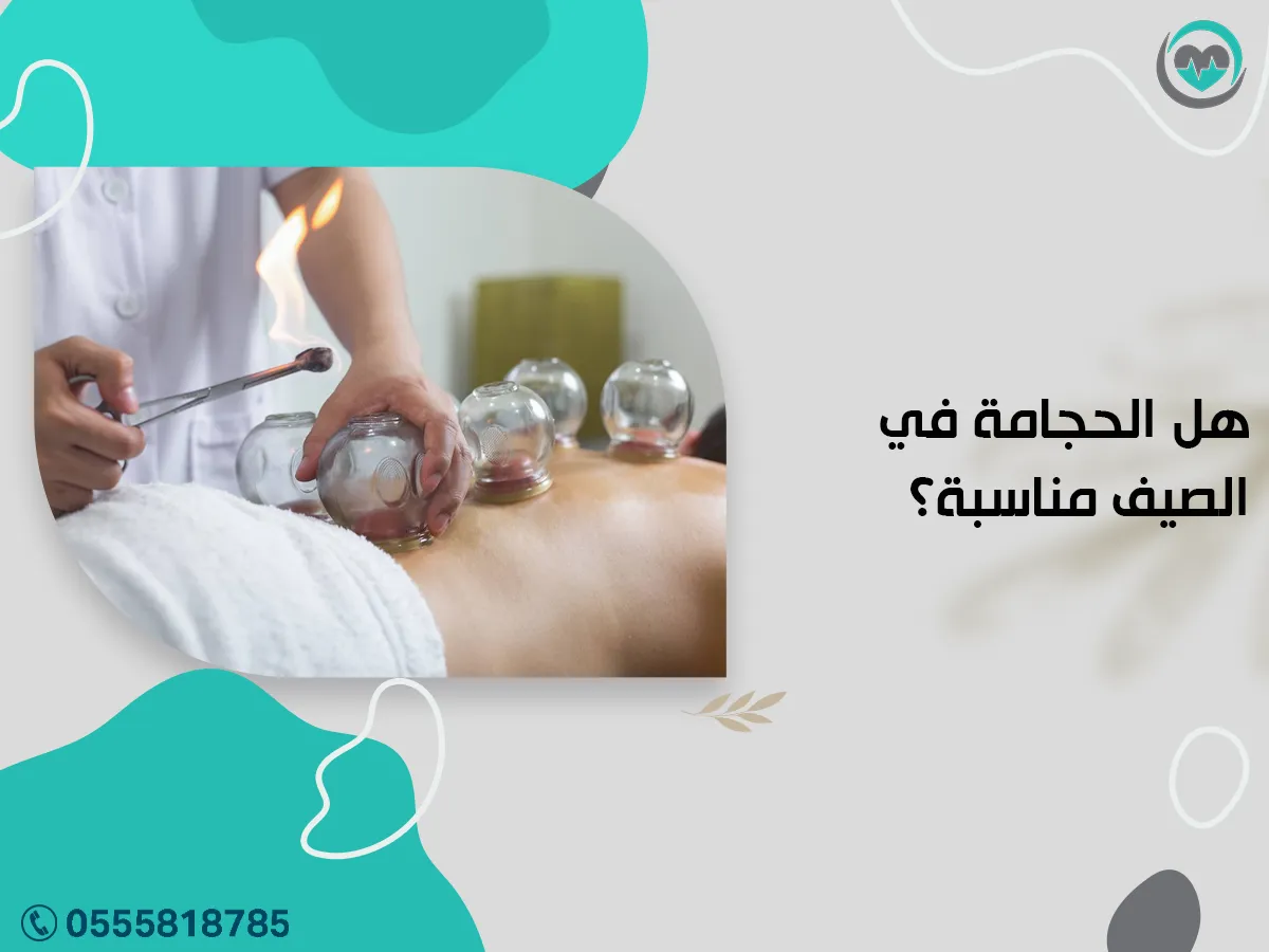 الحجامة في الصيف مناسبة؟