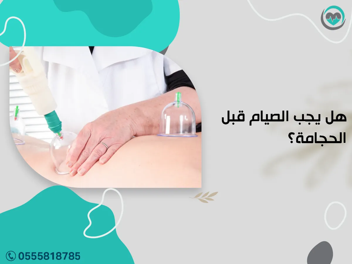يجب الصيام قبل الحجامة؟