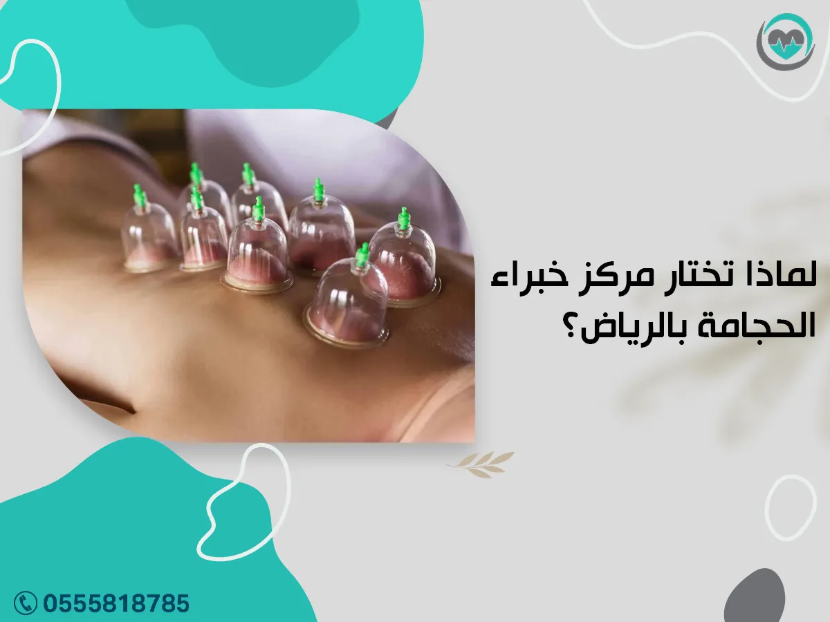 لما تختار مركز خبراء الحجامة بالرياض؟