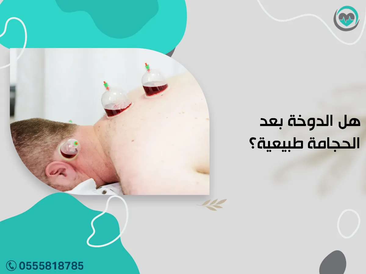 الدوخة بعد الحجامة طبيعية؟