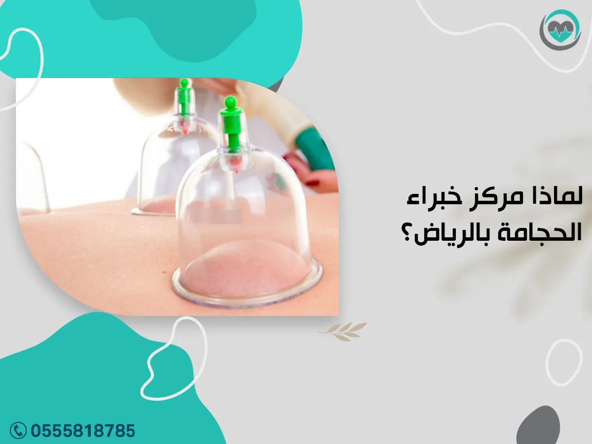 لما مركز خبراء الحجامة بالرياض؟