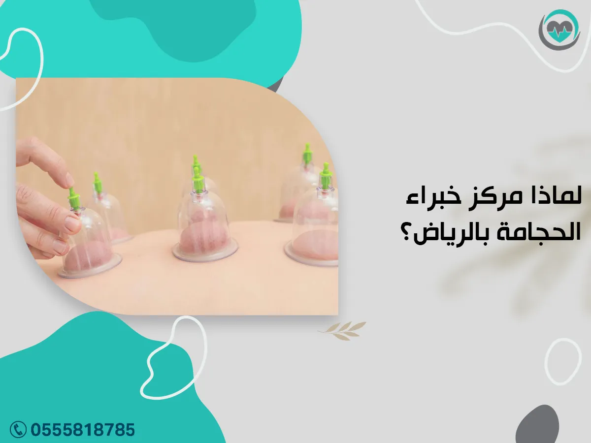 لما مركز خبراء الحجامة بالرياض؟