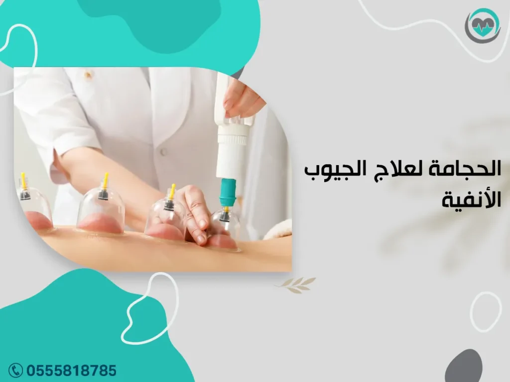 الحجامة لعلاج الجيوب الأنفية