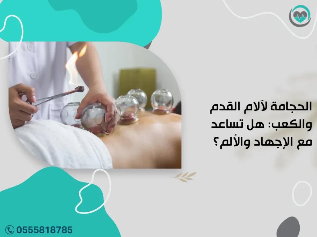 الحجامة لآلام القدم والكعب: هل تساعد مع الإجهاد والألم؟