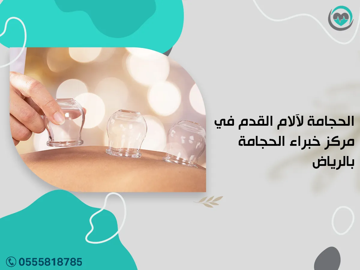 الحجامة لآلام القدم في مركز خبراء الحجامة بالرياض