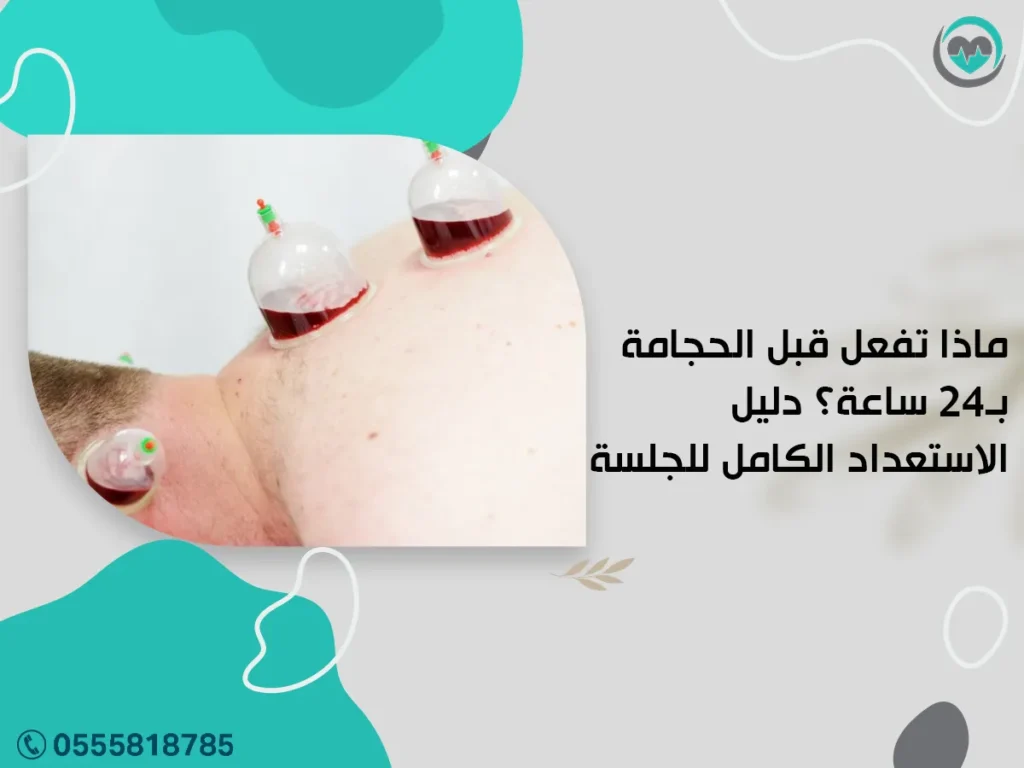 ماذا تفعل قبل الحجامة بـ24 ساعة؟ دليل الاستعداد الكامل للجلسة