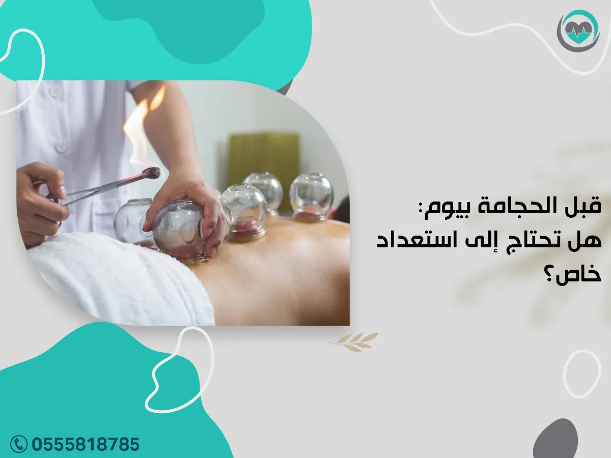 قبل الحجامة بيوم: هل تحتاج إلى استعداد خاص؟