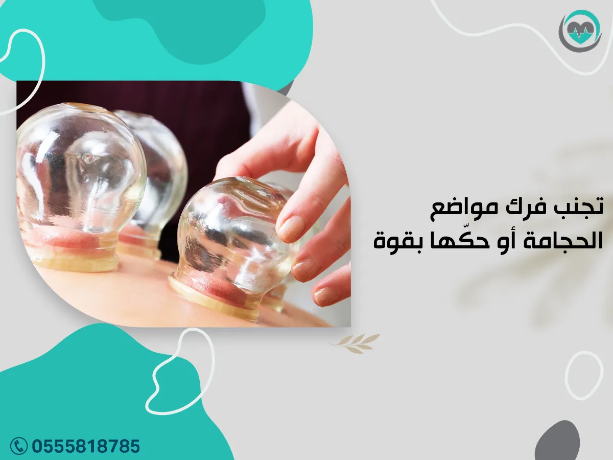 تجنب فرك مواضع الحجامة أو حكّها بقوة