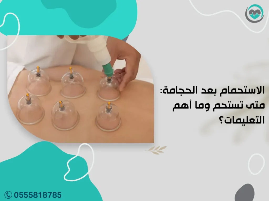 الاستحمام بعد الحجامة: متى تستحم وما أهم التعليمات؟