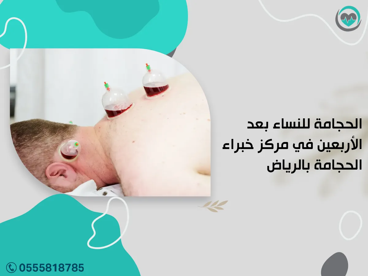 الحجامة للنساء بعد الأربعين في مركز خبراء الحجامة بالرياض