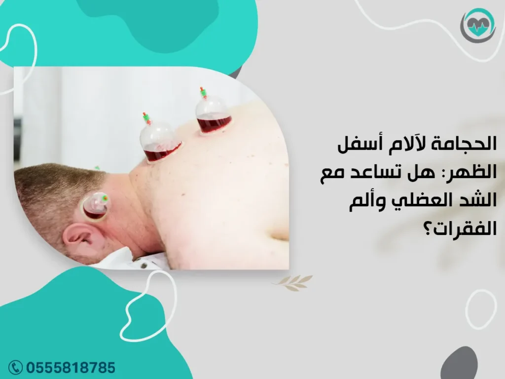 الحجامة لآلام أسفل الظهر: هل تساعد مع الشد العضلي وألم الفقرات؟